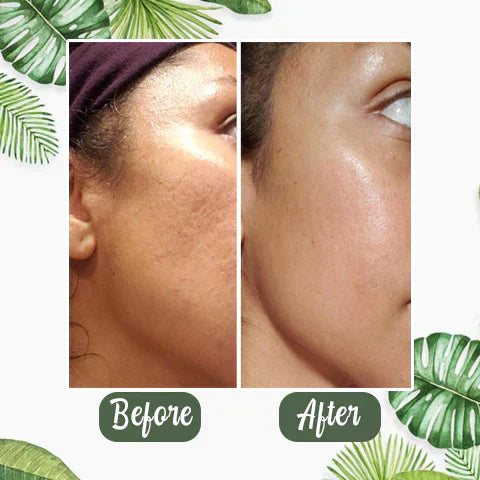 🌿 GreenGlow™ – Din hemmelighed til klar hud og selvtillid | 1+1 Gratis