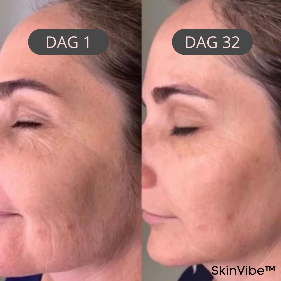 SkinVibe™ - Skønhed begynder med selvpleje