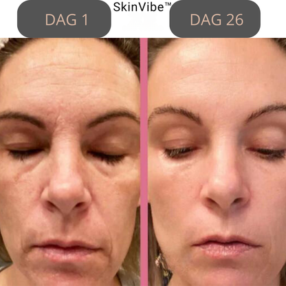 SkinVibe™ - Skønhed begynder med selvpleje