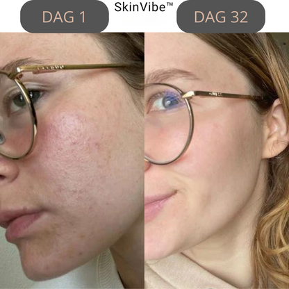 SkinVibe™ - Skønhed begynder med selvpleje