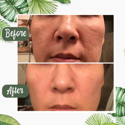 🌿 GreenGlow™ – Din hemmelighed til klar hud og selvtillid | 1+1 Gratis